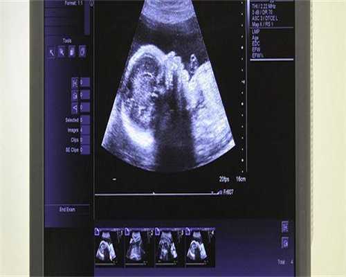 与自然怀孕的宝宝相比，试管婴儿生的宝宝更聪明吗?