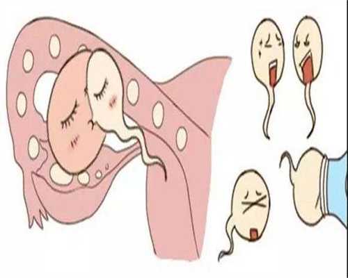 找人代生孩子-试管婴儿真实经历感受是？