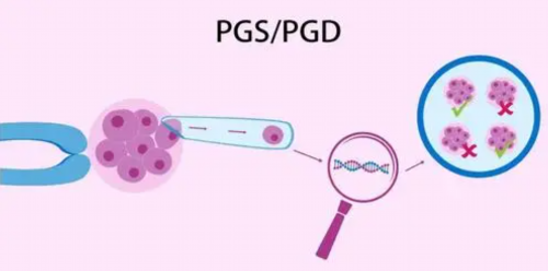 「卵巢过度综合征」卵巢过度综合征应该怎么办