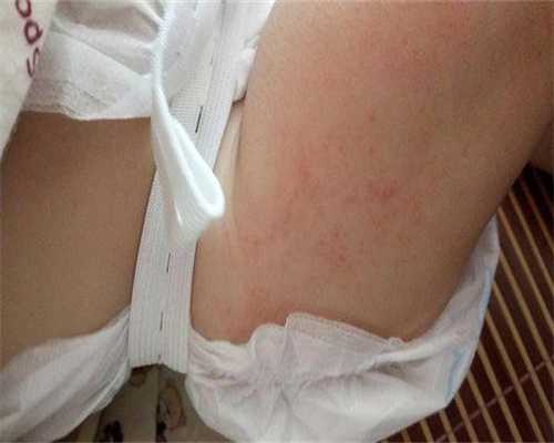 第二代试管婴儿移植一次成功几率是多少第二代试管婴儿移植一般几次成功