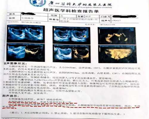 代怀孕价格-湘潭市中心医院试管婴儿多少钱？主要有哪些花销？