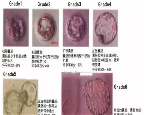 生男孩子代怀-怀孕初期雌激素低怎么办