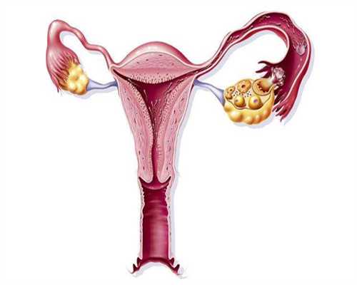 借卵价格-宫腔黏连在长沙做试管哪个医院好，长沙宫腔粘连做三代试管的医院及费用介绍