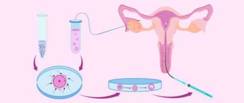 郴州试管婴儿多少钱明细表（不低于9883元）